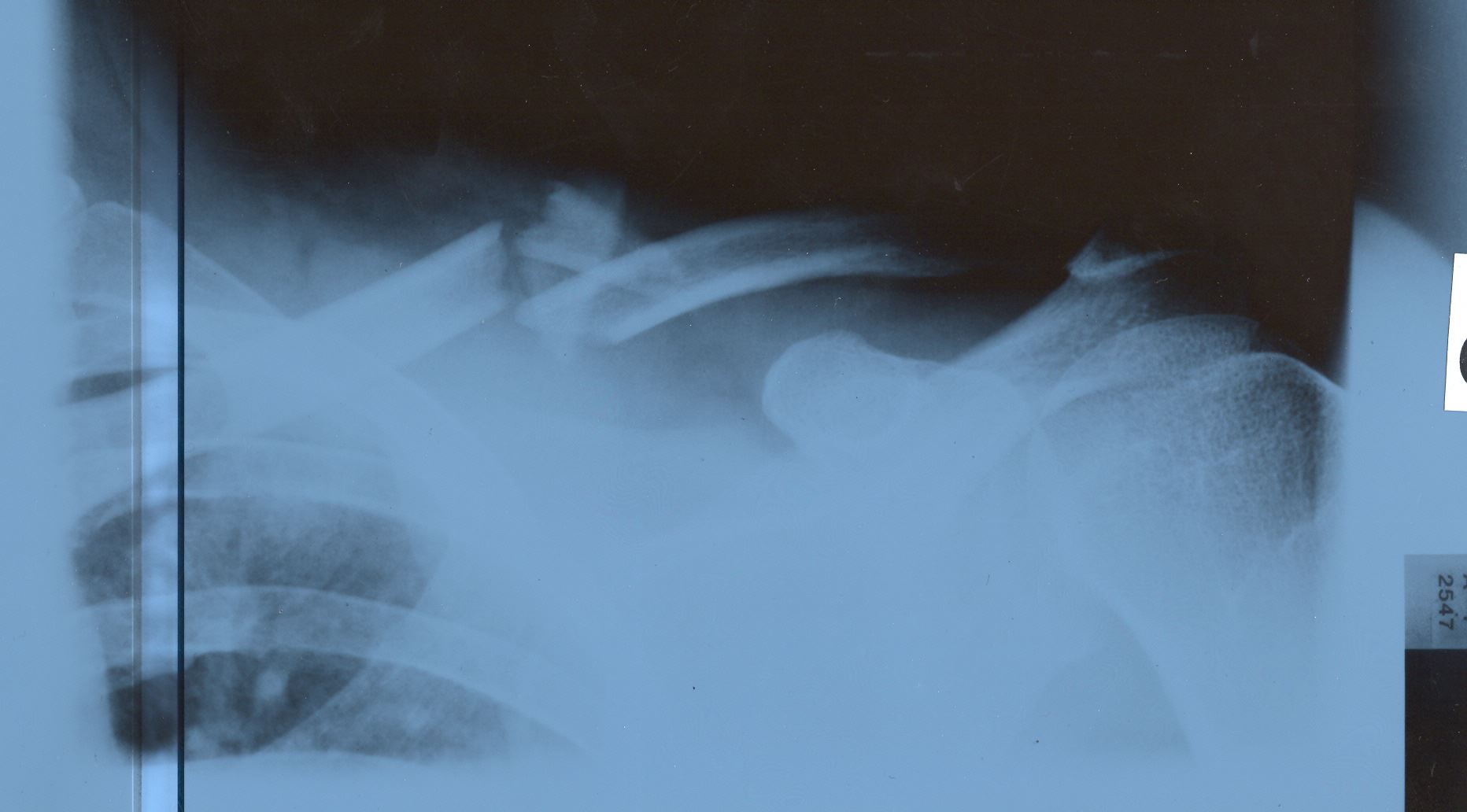 adr15.jpg 
1,864 x 1,032 JPEG-compressed image 
(109,786 bytes)