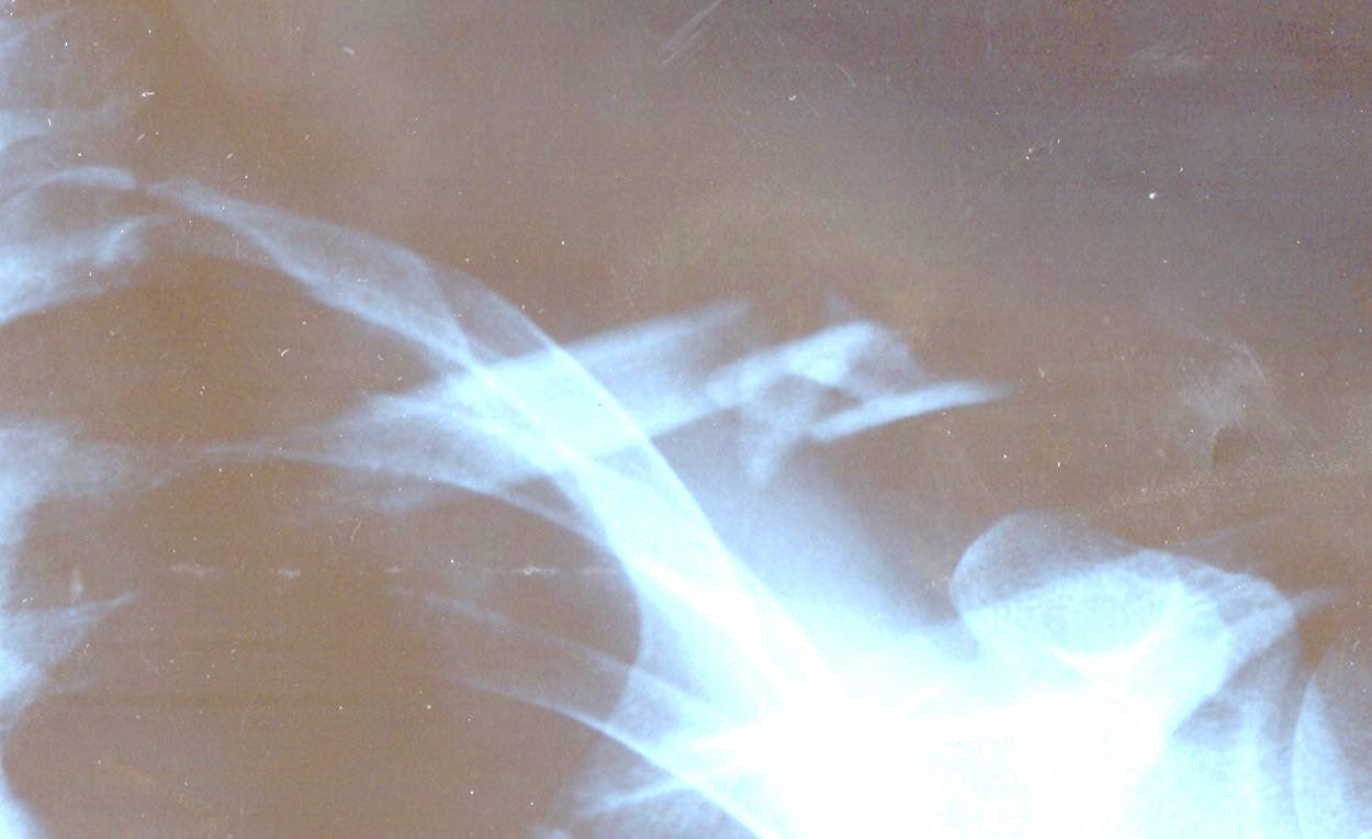 adr16.jpg 
1,250 x 764 JPEG-compressed image 
(83,165 bytes)